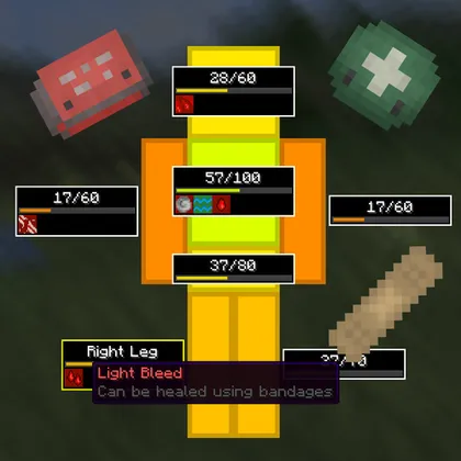 Medical System — Minecraft mod, rasm 1